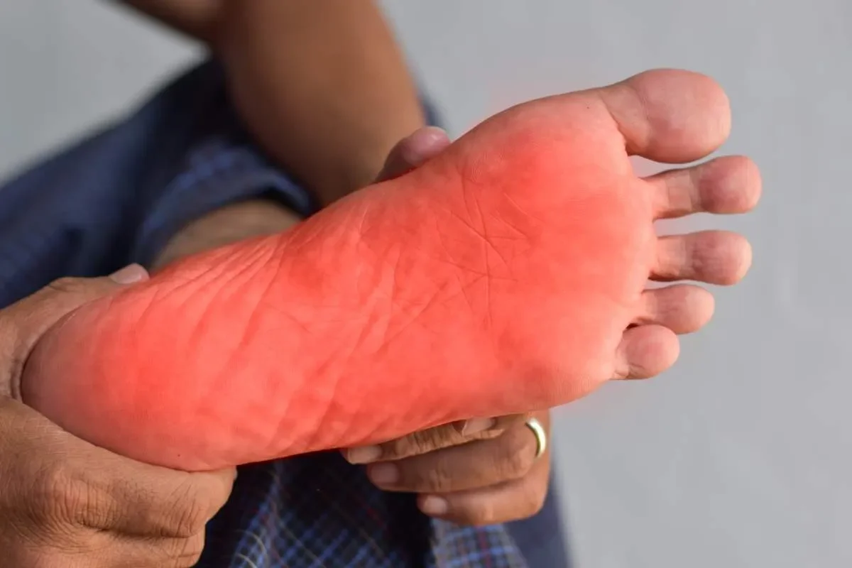 Comment traiter une neuropathie des pieds efficacement ?
