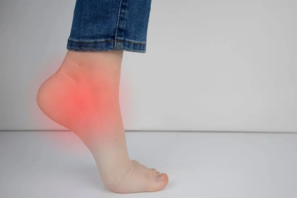 Tendinite sous le pied : remède de grand-mère efficace