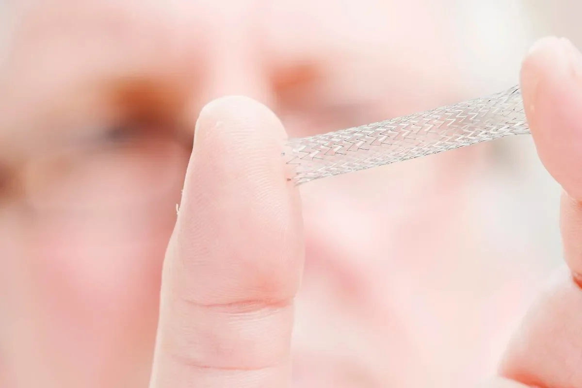 Impact des stents sur l’espérance de vie